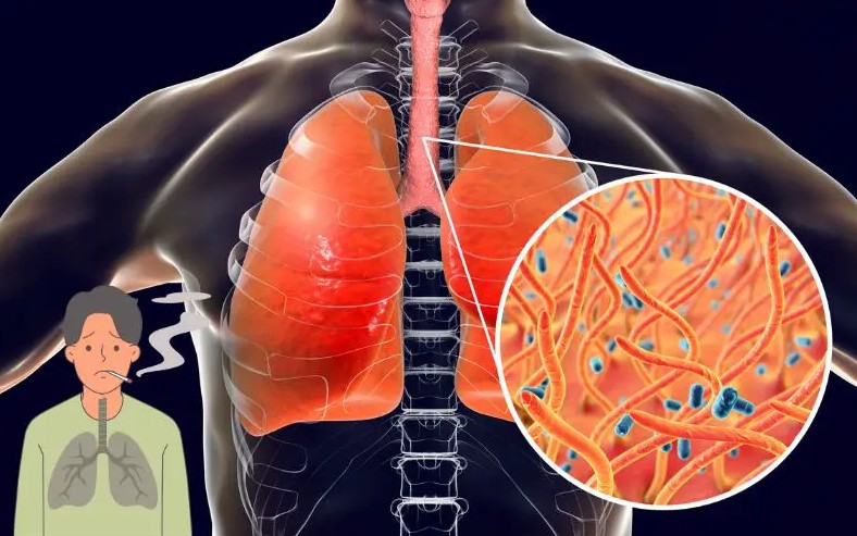 How to Naturally Clear Phlegm and Mucus from Chest and Throat