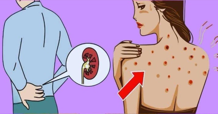 10 Warning Signs Your Kidneys May Be in Danger